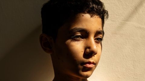<strong>"Mahmoud Ajjour, Aged Nine."</strong> Mahmoud Ajjour, who was injured during an <a href="index.php?page=&url=https%3A%2F%2Fwww.cnn.com%2Fworld%2Fmiddleeast%2Fisrael">Israeli attack on Gaza City</a> in March 2024, finds refuge and medical help in Doha, Qatar, on June 28, 2024. Winner, World Press Photo of the Year.