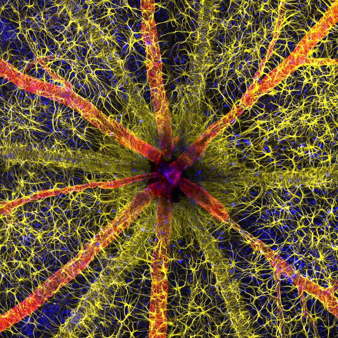 Diabetes researcher Hassanain Qambari, assisted by Jayden Dickson, captured the optic nerve head of a rodent in a web of color.