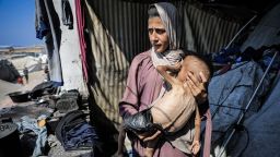 Muhammad Zakariya Ayyoub al-Matouq, a 1.5-year-old child in Gaza City, Gaza, faces life-threatening malnutrition as the humanitarian situation worsens due to ongoing Israeli attacks and blockade, on July 21, 2025.