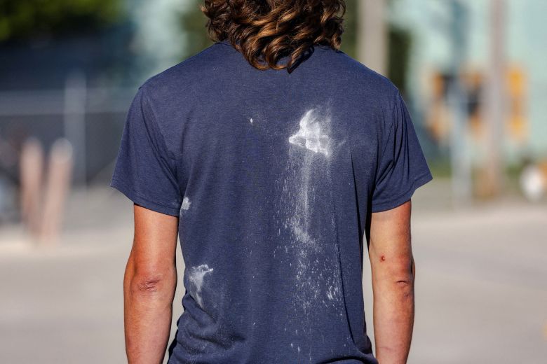 A protester's shirt is covered in pepper ball residue after federal agents fired on protesters outside of the Broadview ICE processing facility, on September 26.