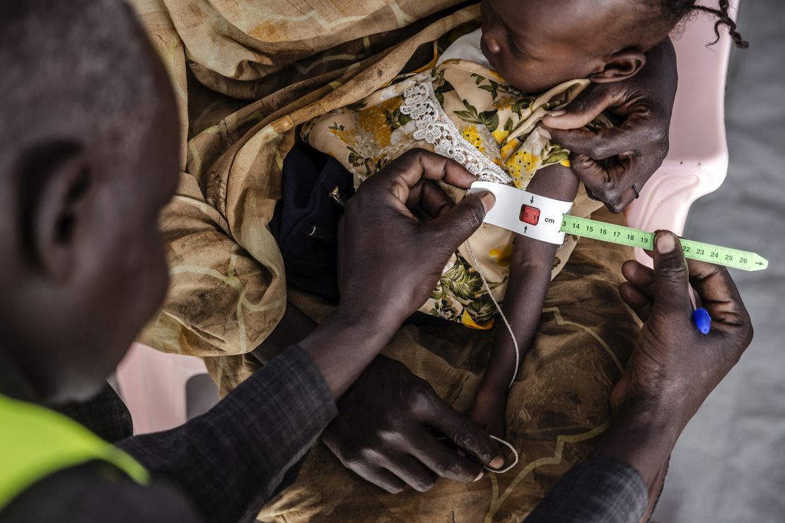 A health worker measures the circumference of a Sudanese child's arm at the clinic of a transit center for refugees in Renk, South Sudan, on February 13, 2024.