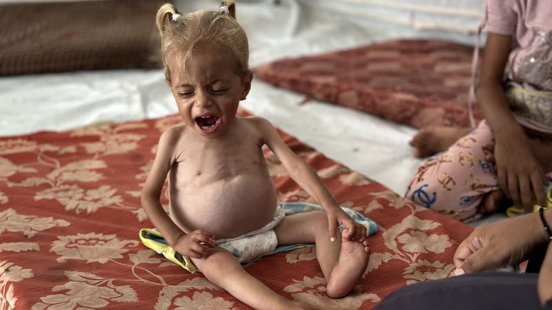 Gaza is starving and outrage is spreading. Will Netanyahu listen? Gaza is starving and outrage is spreading. Will Netanyahu listen?