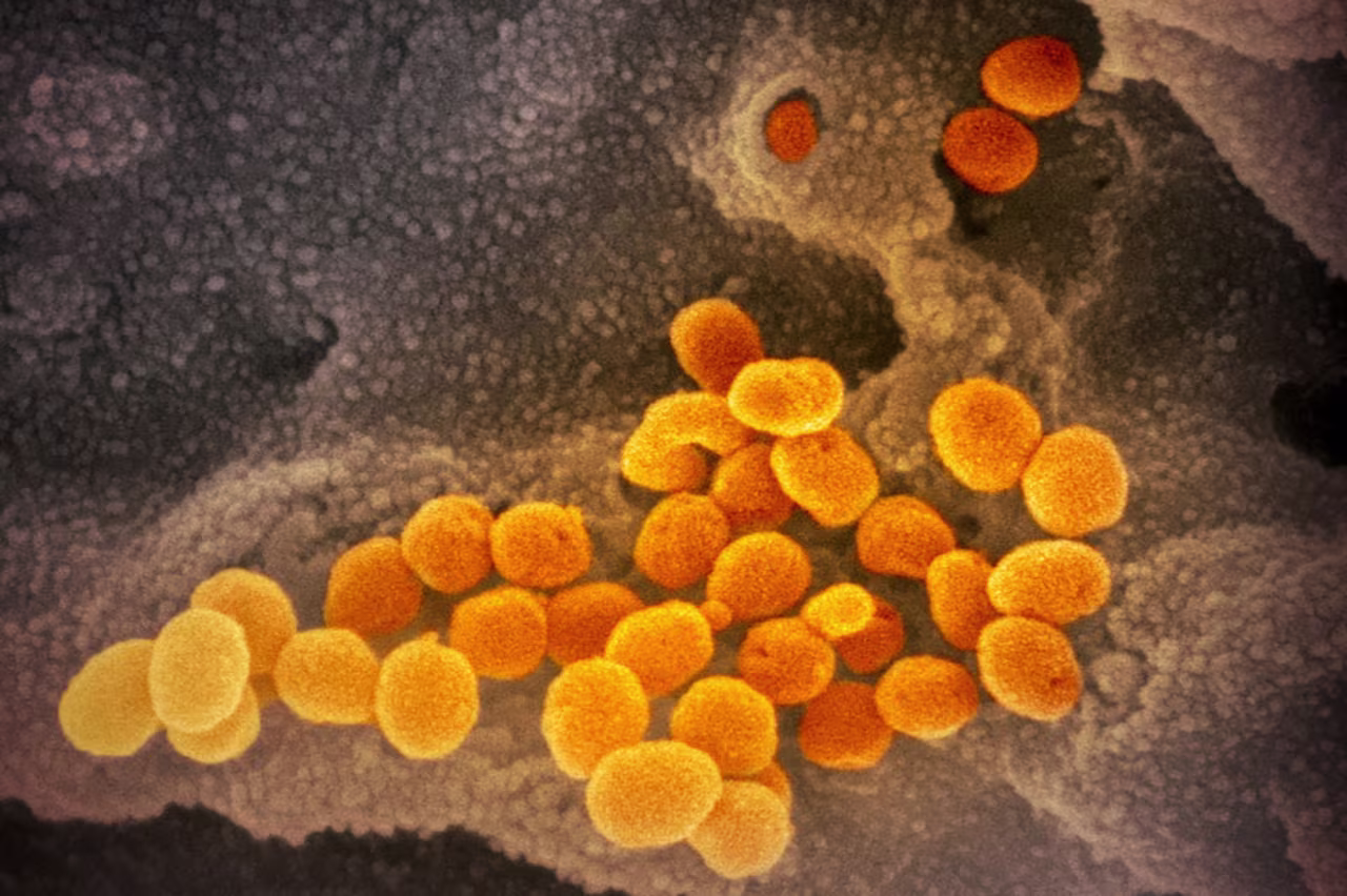 This scanning electron microscope image shows 2019-nCoV, the virus that causes Covid-19—isolated from a patient in the U.S.