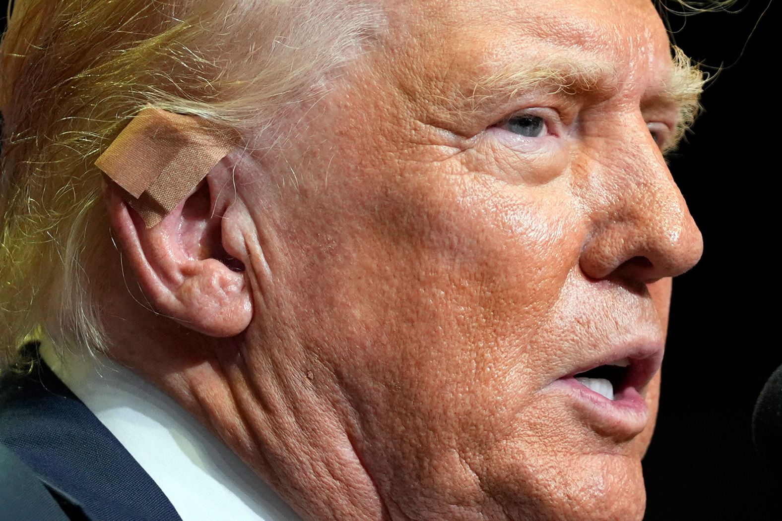 A bandage is seen on the right ear of former US President Donald Trump as he speaks at a campaign rally in Grand Rapids, Michigan, on Saturday, July 20. Trump’s ear was shot during an <a href="index.php?page=&url=https%3A%2F%2Fwww.cnn.com%2F2024%2F07%2F13%2Fpolitics%2Fgallery%2Fin-pictures-trump-injured-at-pennsylvania-rally%2Findex.html">assassination attempt</a> earlier this month.