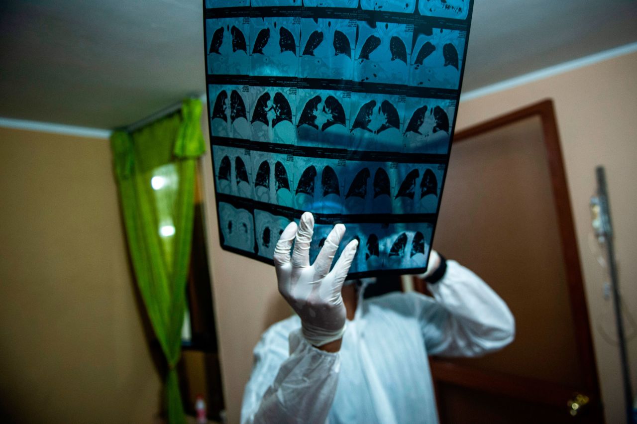 A doctor checks an X-ray of a Covid-19 patient at a home on the eastern outskirts of Lima, Peru on January 22.