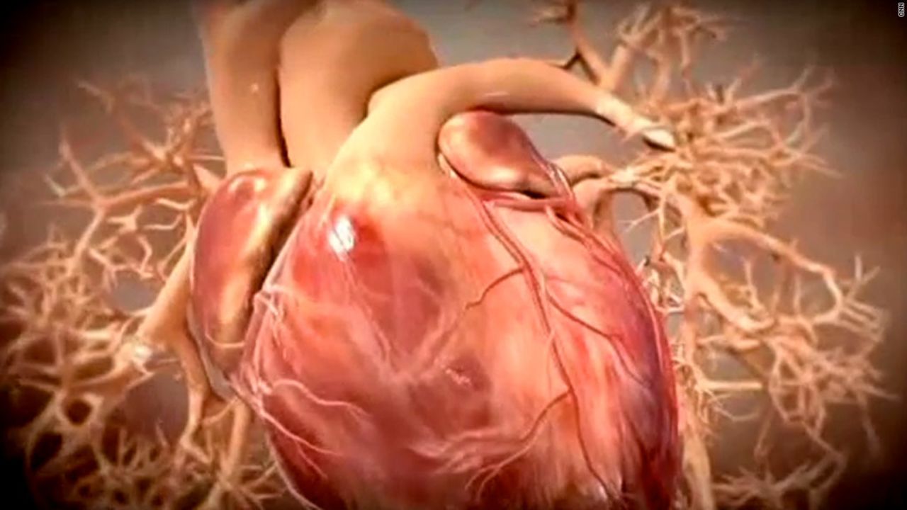 Heart failure affects nearly 6 million Americans