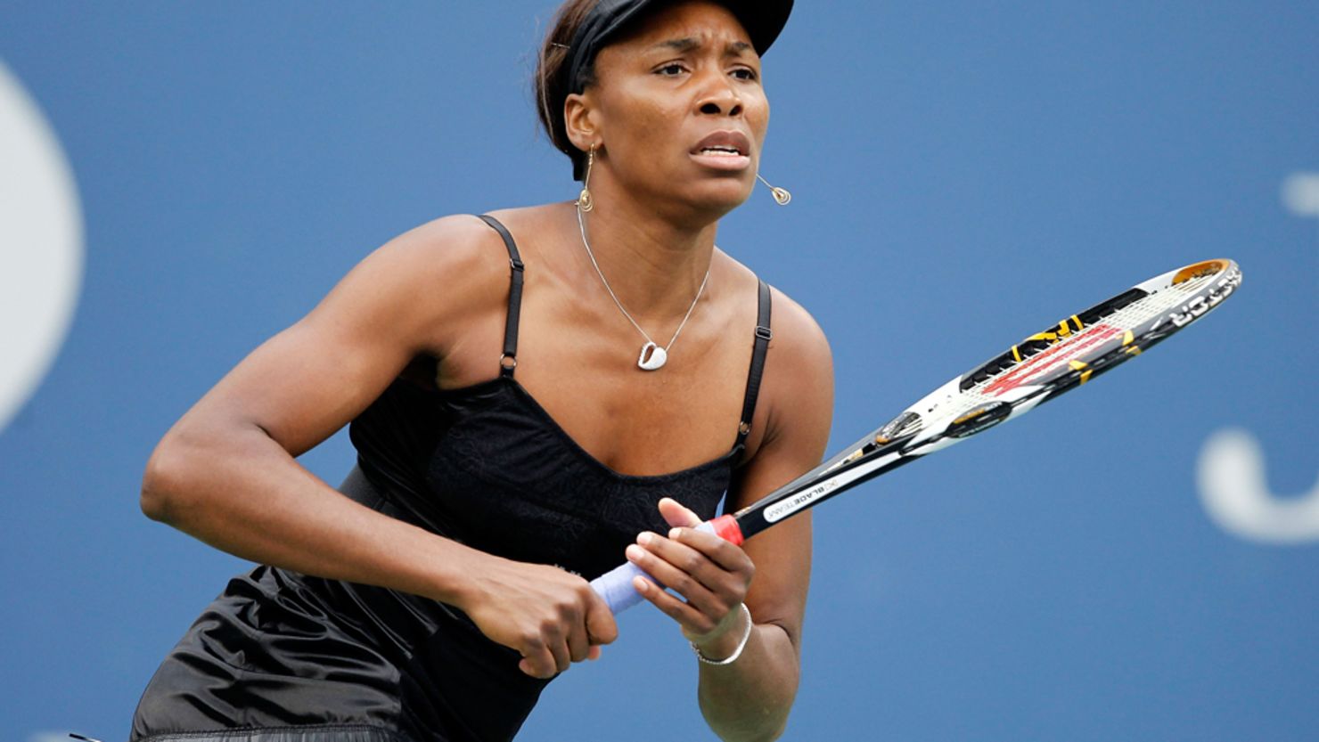 Elite athletes like Venus Williams may be more likely to receive an earlier diagnosis. 