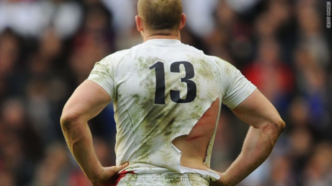 A red rose to a bull: England's Mike Tindall bears the scars and a torn shirt after finding himself on the end of a few boots while at the bottom of a ruck. 
