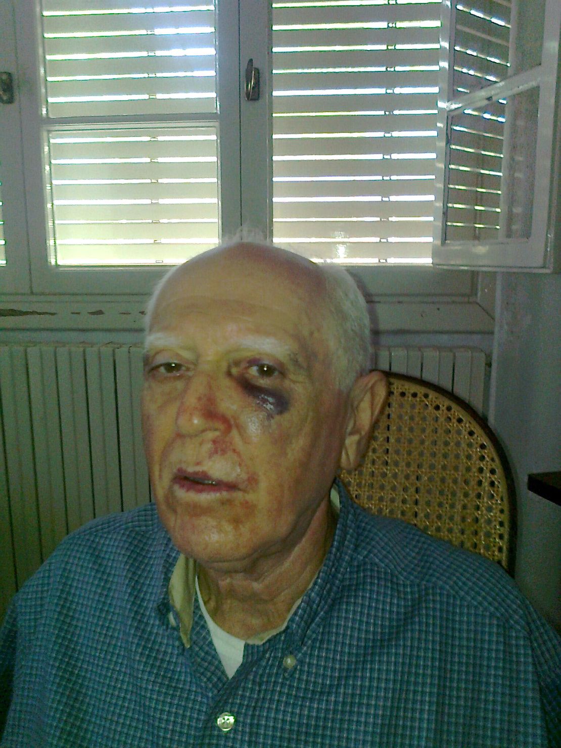 Dr. Mamoun Jandali was bound, gagged and beaten by three men in July.