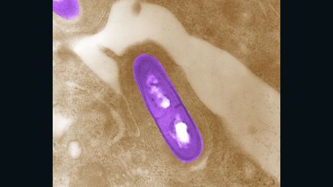 This photo is an electron micrograph of a listeria bacterium in tissue.