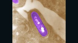 This is a photo from the CDC of the Listeria bacteria. 
