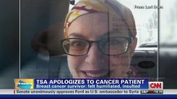 TSA apologizes to cancer survivor_00002001