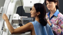 A women gets a mammogram done, a screening for breast cancer. 