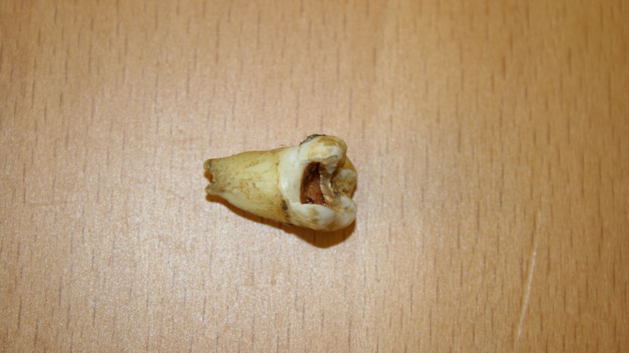 A molar said to have belonged to the late John Lennon will be going up for auction.