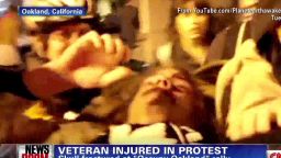 nr veteran injured oakland protest_00000423