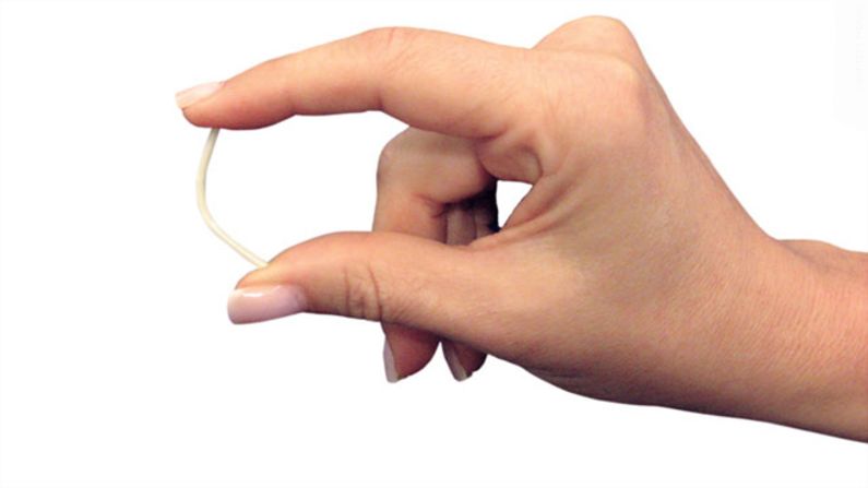 Implants are flexible matchstick-size devices that are surgically inserted into a woman's arm. They slowly release the hormone progestin into the body, preventing a woman's ovaries from releasing eggs. The protection can last several years. 