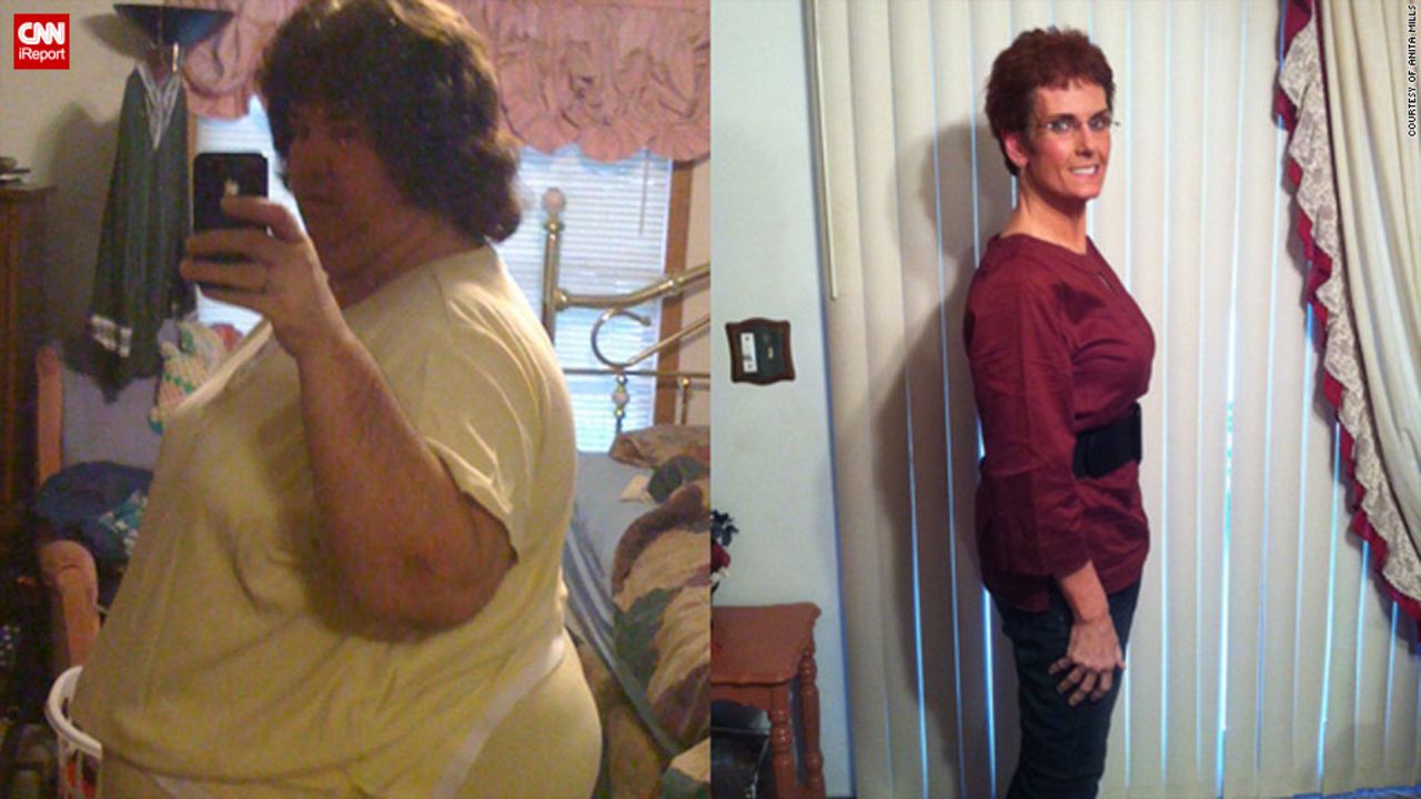 Anita Mills lost 242 pounds by telling no one that she was on a diet. 