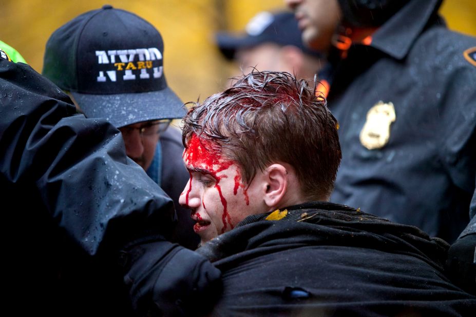A young man is seen with blood on his face after a confrontation with police in Zuccotti Park. It's unclear how many demonstrators have been injured during the clashes.