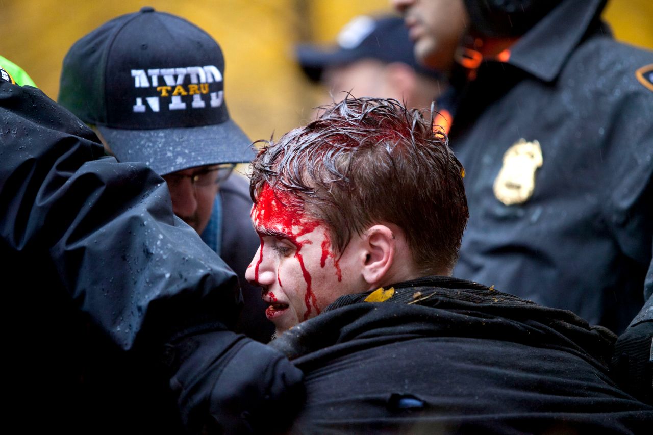 A young man is seen with blood on his face after a confrontation with police in Zuccotti Park. It's unclear how many demonstrators have been injured during the clashes.