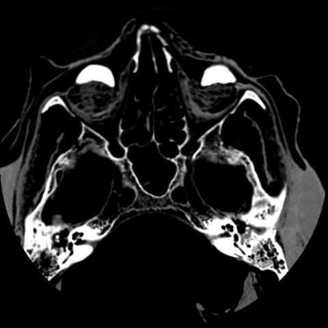 A CT scan of Djeddjehutyiuefankh's skull, undertaken at an Oxford hospital. 