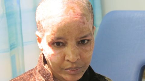 Shweyga Mullah is recovering but still faces almost daily hospital appointments.