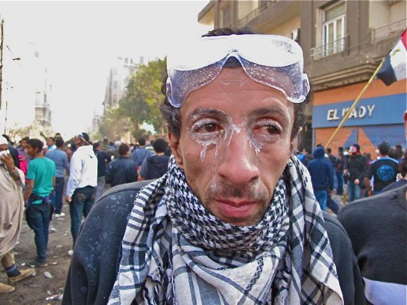 An Egyptian shows the residue on his face Wednesday after police used tear gas during clashes with protesters. 