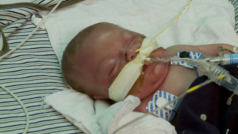 The mother of an infant with a medical condition is battling Medicaid ...