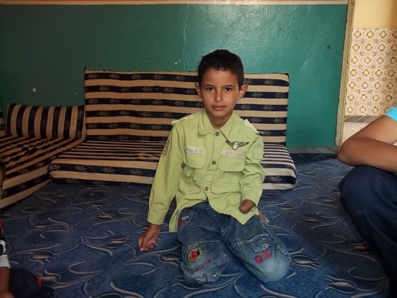 Nine-year-old Mahmood lost a hand after hitting an anti-aircraft machine gun bullet with a stone to see what was inside.