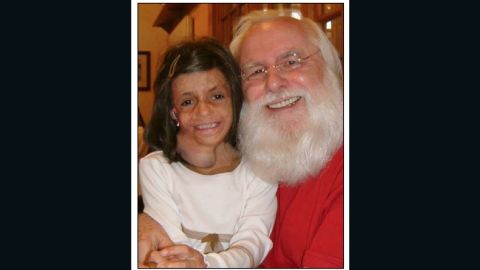 Teeba, injured in Iraq, now has her own special Santa in Santa Lou, who gave the girl his sleigh phone number.