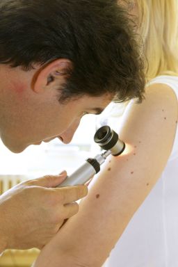 Melanoma, though a skin cancer, can spread to the lungs, liver, bone, lymph nodes and brain.