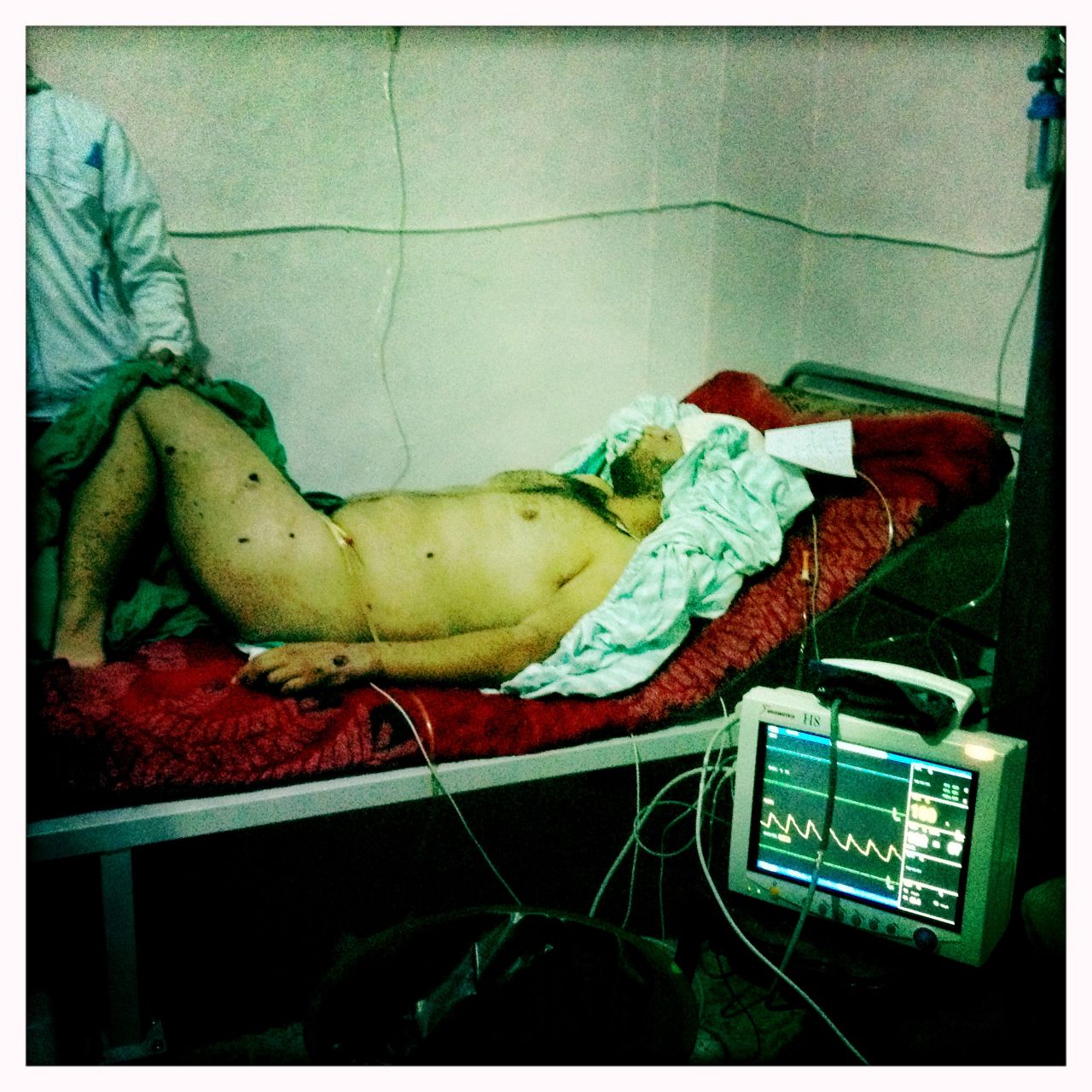 The journalist said this man was shot in the head by a sniper, while the wounds on his body were sustained from a nail bomb. He receives basic treatment at a makeshift hospital in Baba Amr in Homs.