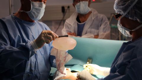 How surgeons build new breasts | CNN