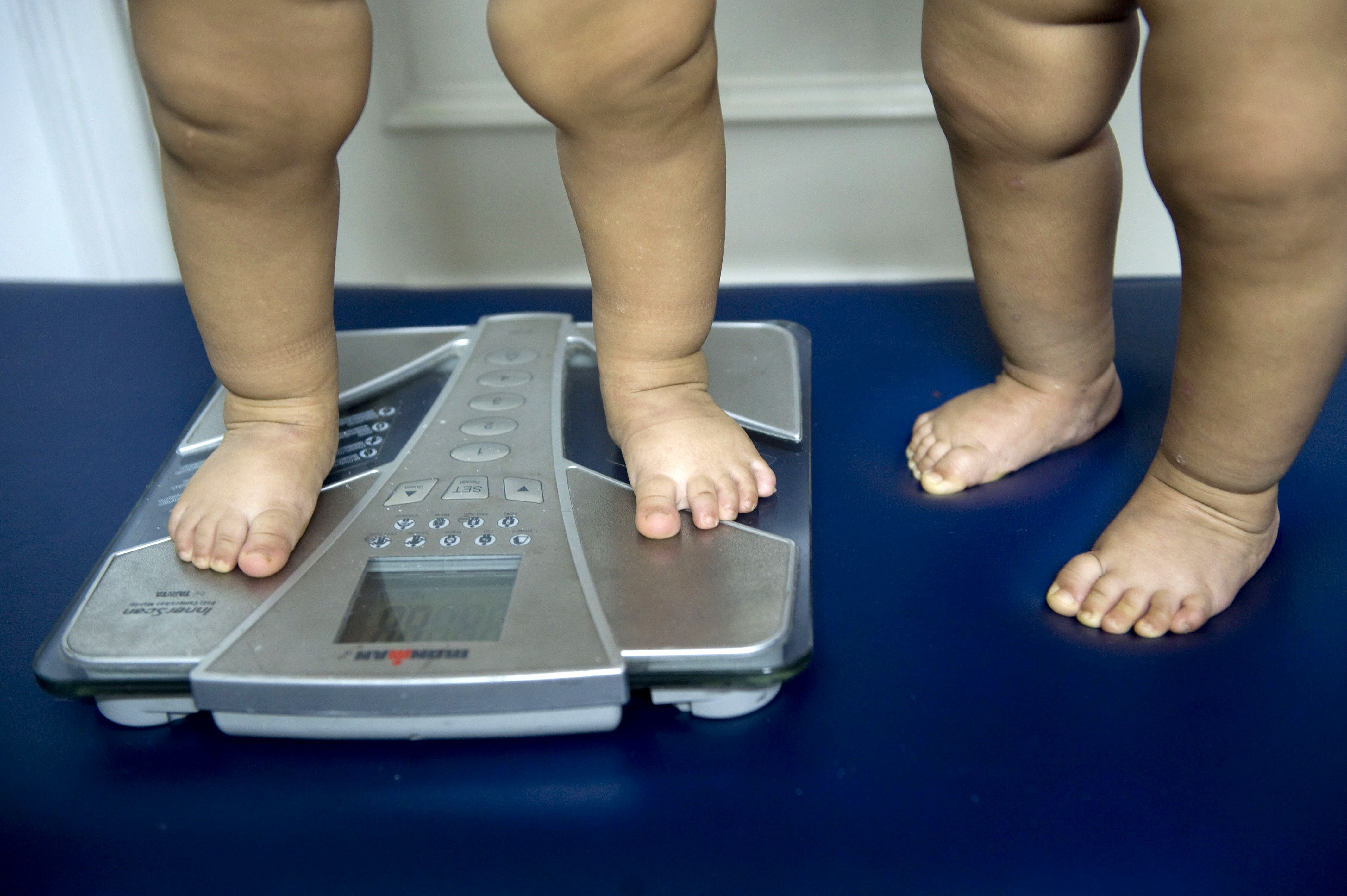 Child and teen obesity soars tenfold worldwide in 40 years