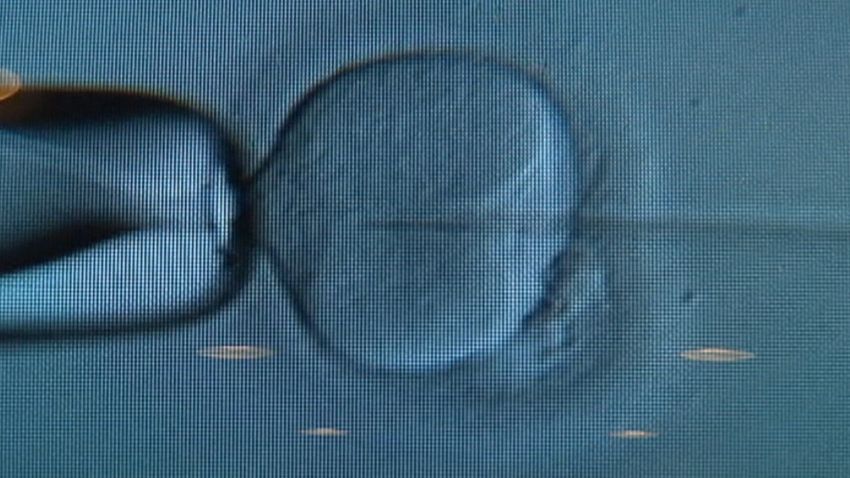 A British medical study discourages transferring three or more embryos.