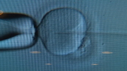 IVF lab embryo boston