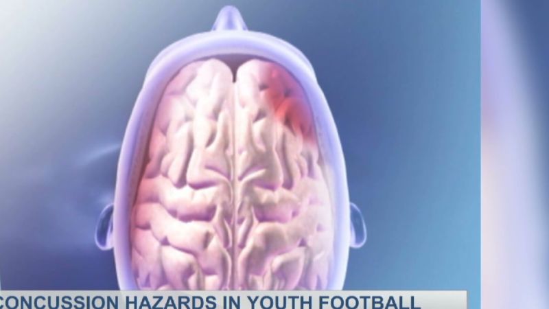 NextImg:NFL Concussions Fast Facts | CNN