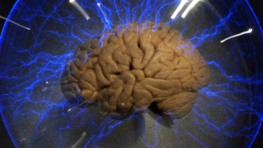 An actual human brain displayed inside a glass box, as part of an interactive exhbition 'Brain: a world inside your head', in Sao Paulo, Brazil, on August 21, 2009.