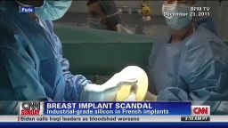 nr.bilchik.breast.implant.arrest_00003614