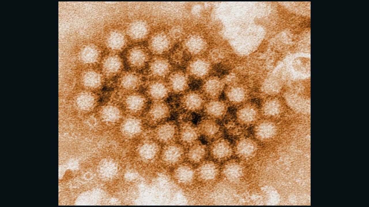 Norovirus virions can live in the environment for up to four weeks.