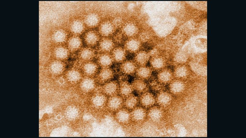 Norovirus leading cause of intestinal disorders in kdis | CNN