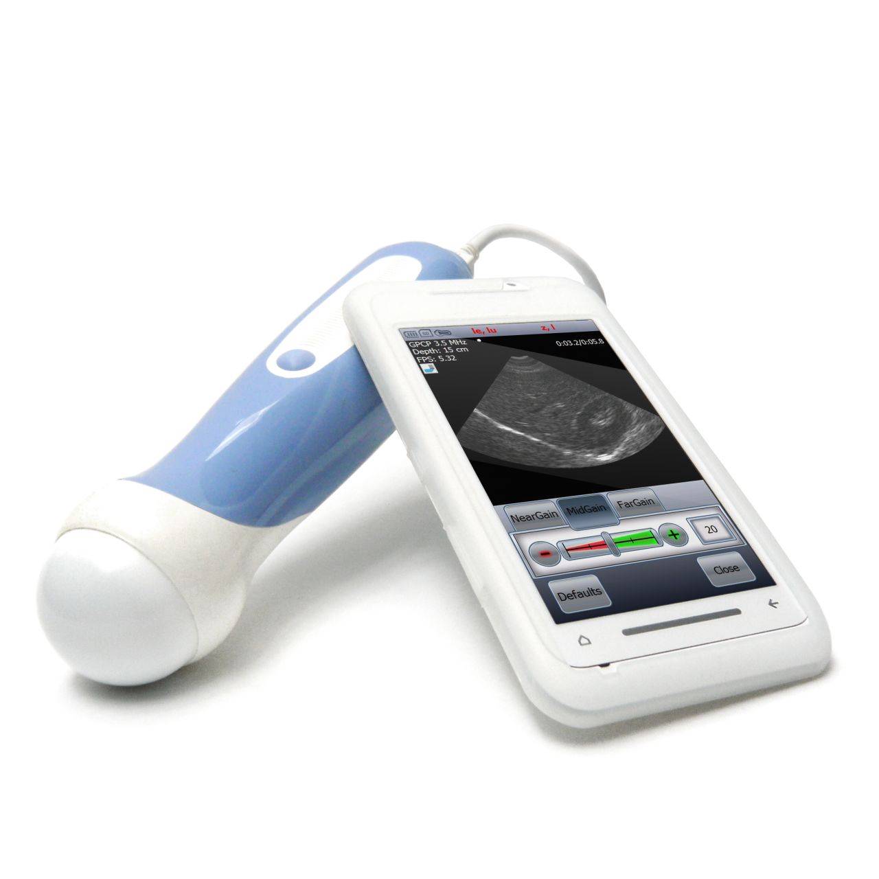 The Mobisante MobiUS SP1 smartphone ultrasound system has the potential to bring ultrasound technology to remote rural areas.