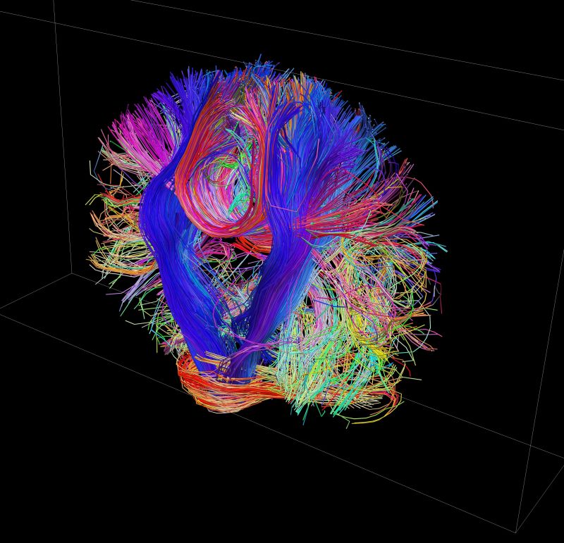 Human Connectome Project | CNN Business