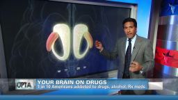 sgmd-your-brain-on-drugs _00011523