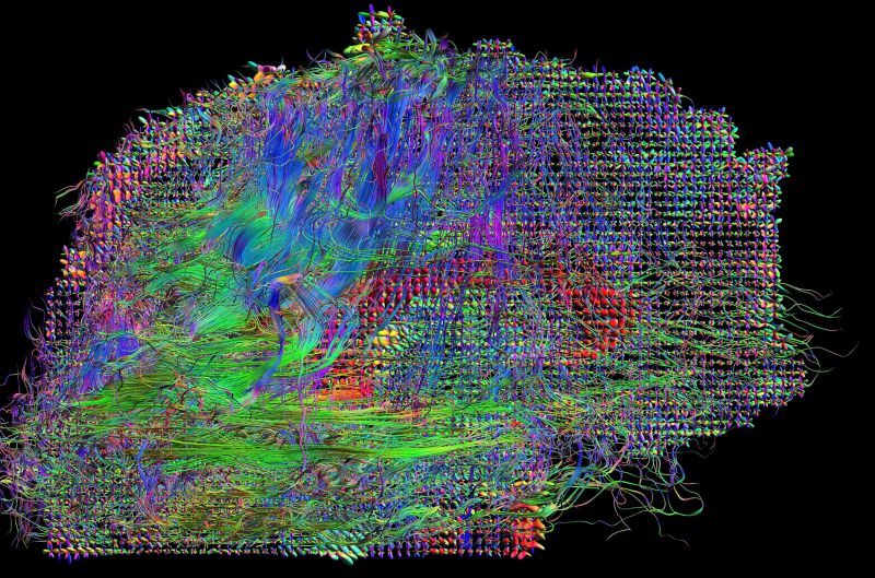 Human Connectome Project | CNN Business