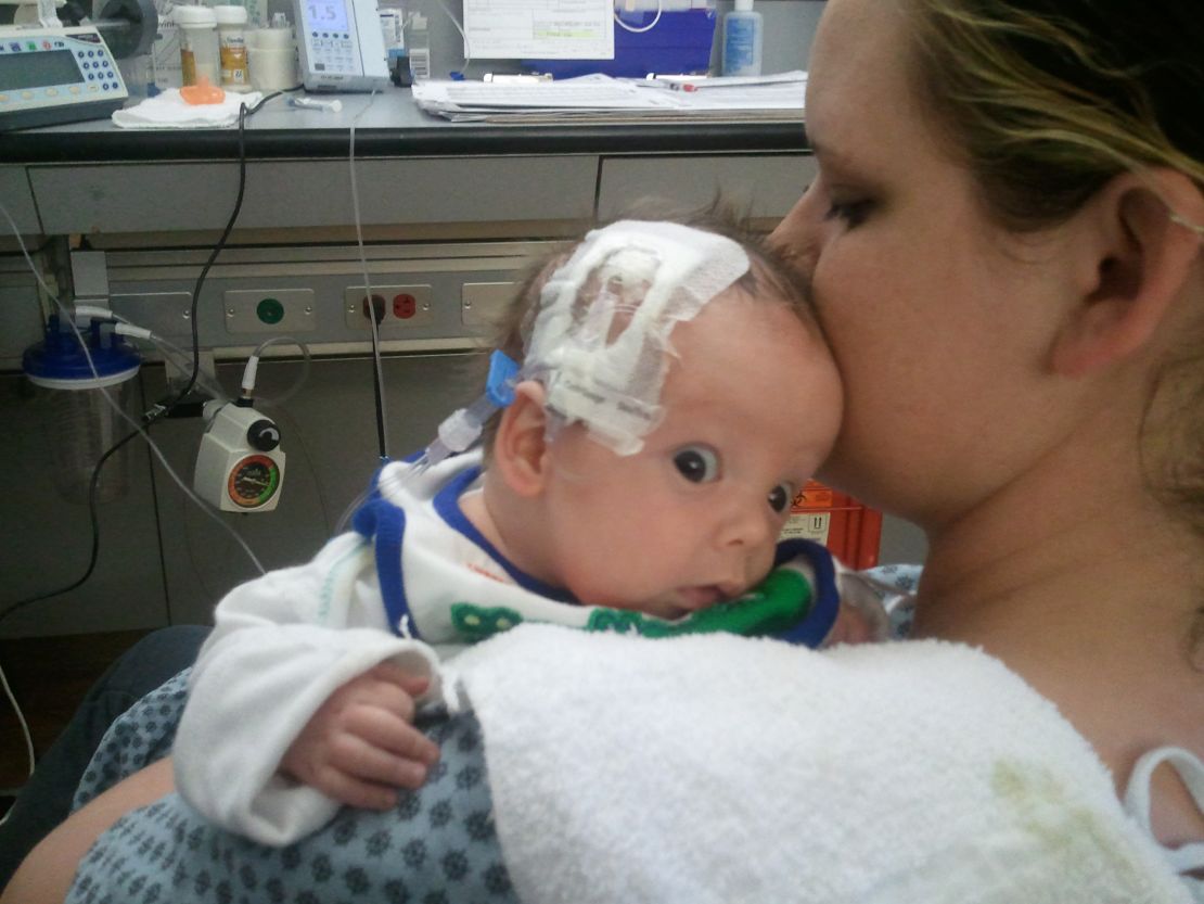 Haleigh Jacobs cuddles her 2-month-old son, Brantley, who has severe medical problems. 