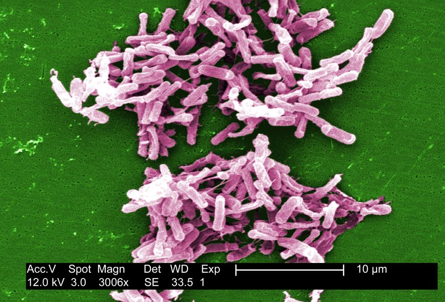 One in six people in the U.S. get sick from foodborne illnesses. Pictured, clostridium difficile bacteria.