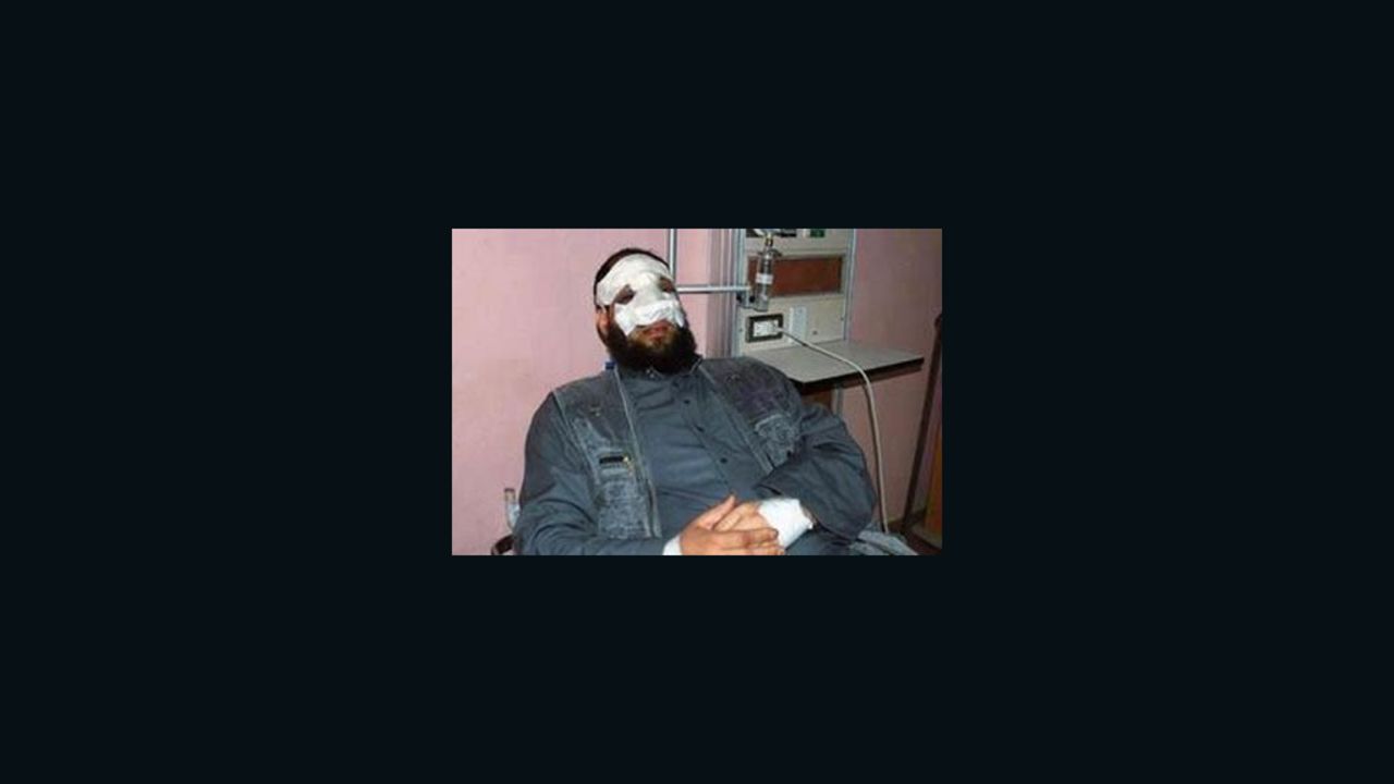 Anwar al-Bilkimy in Cairo's Selmi hospital