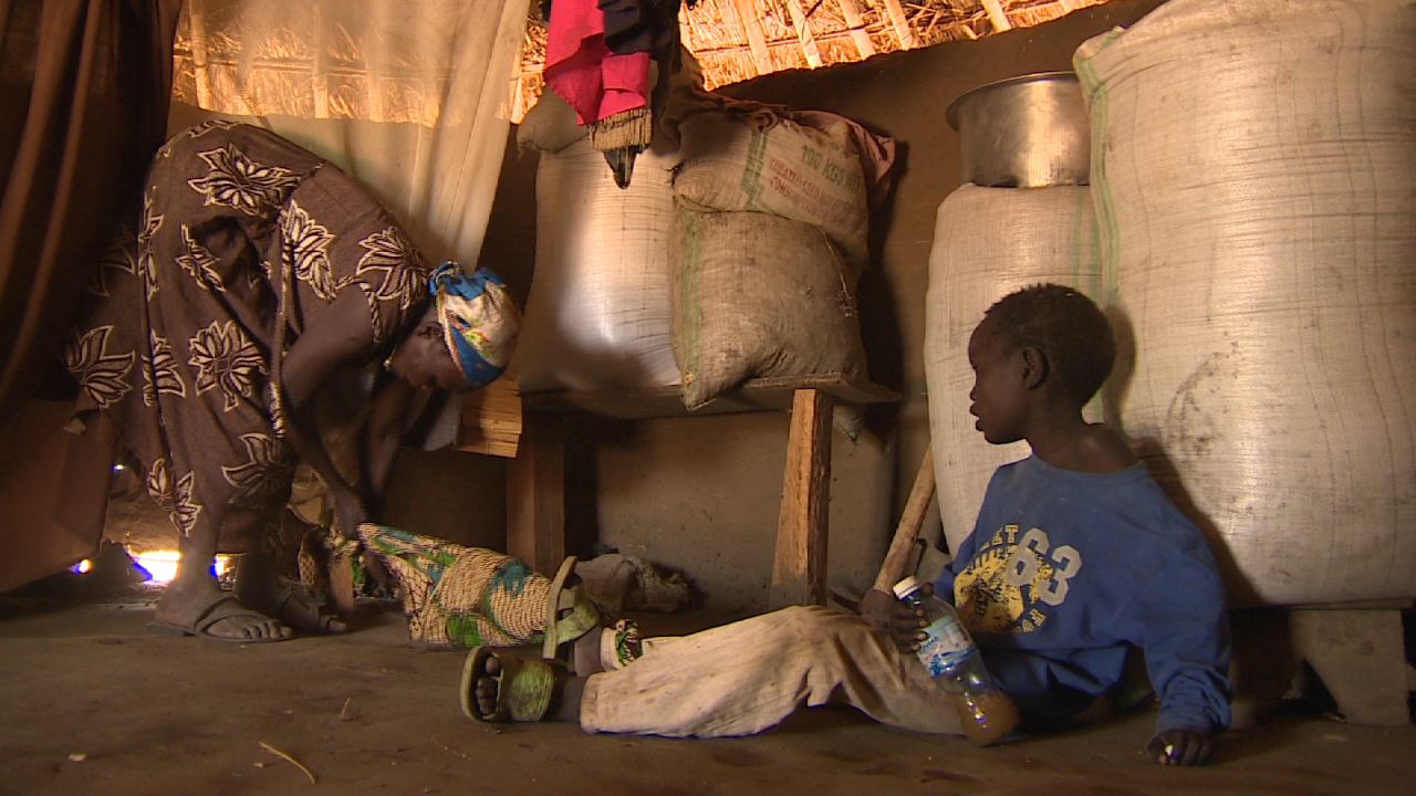 Grace Lagat ties up her seven-year-old son Thomas, who suffers from Nodding Disease, so he can't wander off when she tends to her field or is out of the homestead in Northern Uganda where more than 3,000 kids have the syndrome.