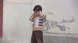 pkg damon syria children wounded_00011628