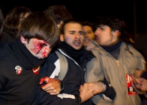 A man is seen bleeding after being struck by police during a national strike in Madrid on March 29.